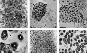 Bacteriile, diversitatea lor